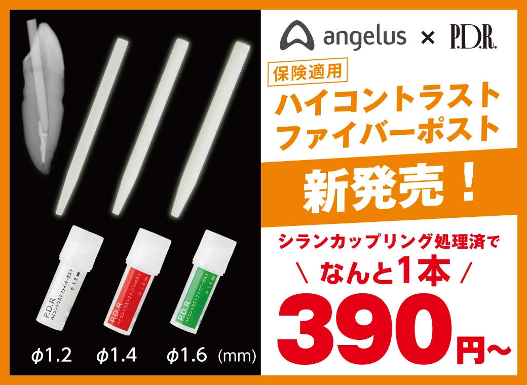 ハイコントラスト
ファイバーポスト新発売セール