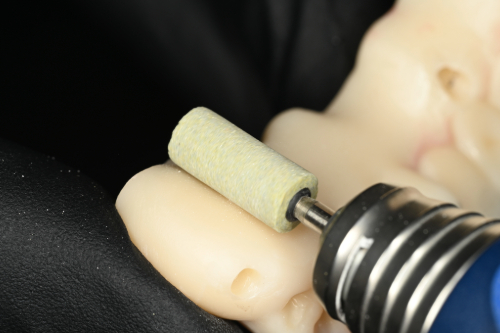 唇側面の修正シーン