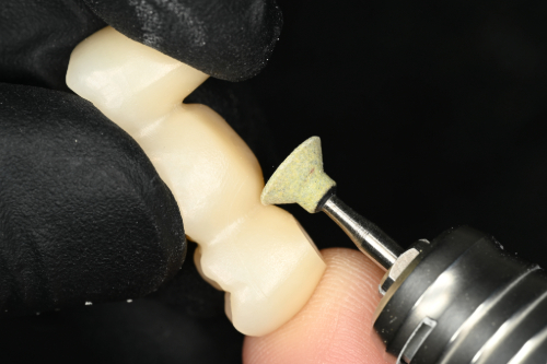 隣接面の修正シーン