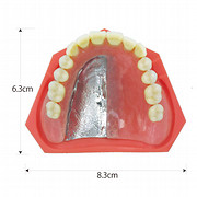 レジン床・金属床対比義歯模型