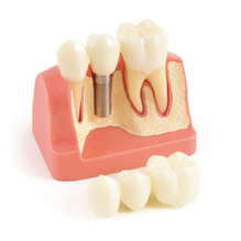 インプラント用モデル